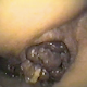 The famous Bowlcam from GirlsPooping.Com featuring Brittanie pooping and wiping her ass from an in-the-toilet bowl perspective! About 5 minutes.